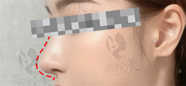 武汉星薇莱妍妍子医疗美容