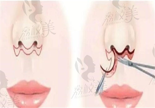Avant整形外科简介