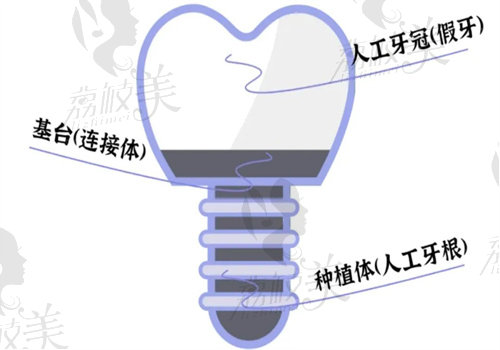 天津常乐口腔种牙怎么样