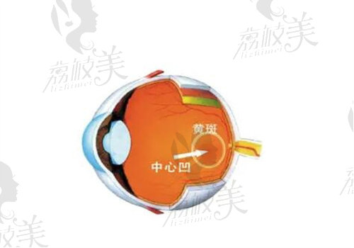 法瑞西单抗纳入医疗保险了吗