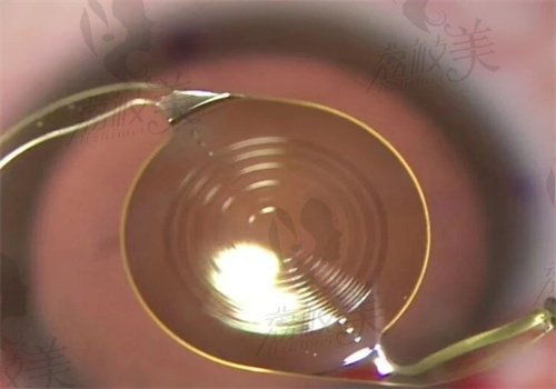 淄博市第 一医院眼科怎么挂号