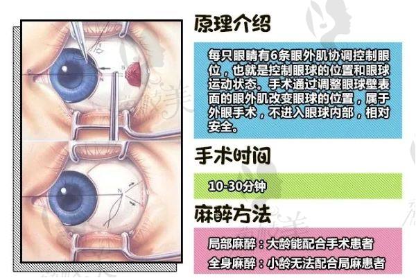 鄭州美視美康眼科醫(yī)院近視手術(shù)醫(yī)生