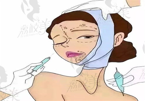 艺星不同分院打童颜针多少钱一支