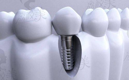 福州同福医口腔医院医疗保险报销吗