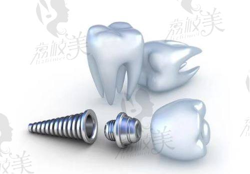 福州同福医口腔医院怎么样