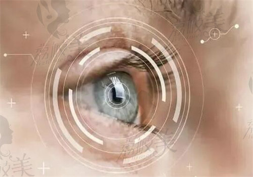 戴星趣控有哪些注意事项