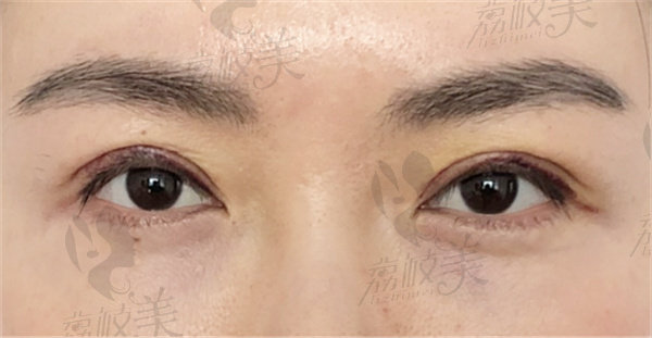 南昌汉美医疗美容门诊部林杰