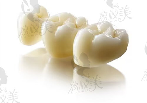 镇江康洁口腔德国威兰德全瓷冠多少钱