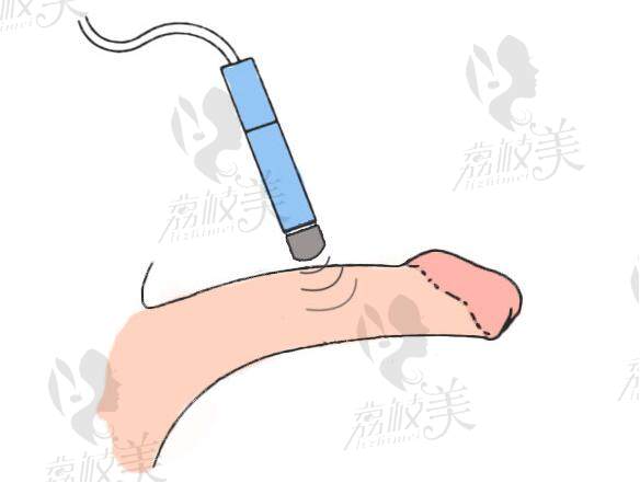 九龙医院男性价格收费一览表