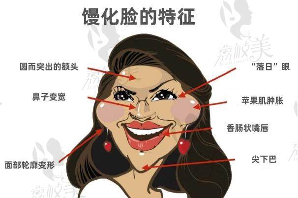 杭州馒化脸修复较好的医生是哪个