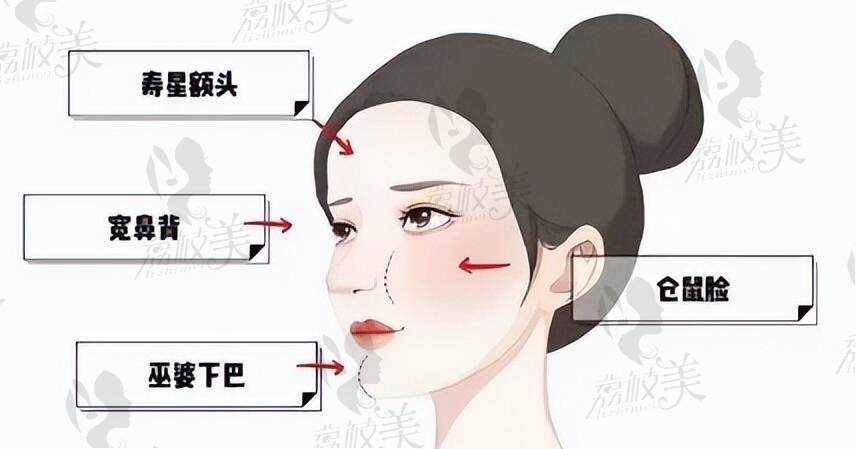 杭州馒化脸修复较好的医生是哪个
