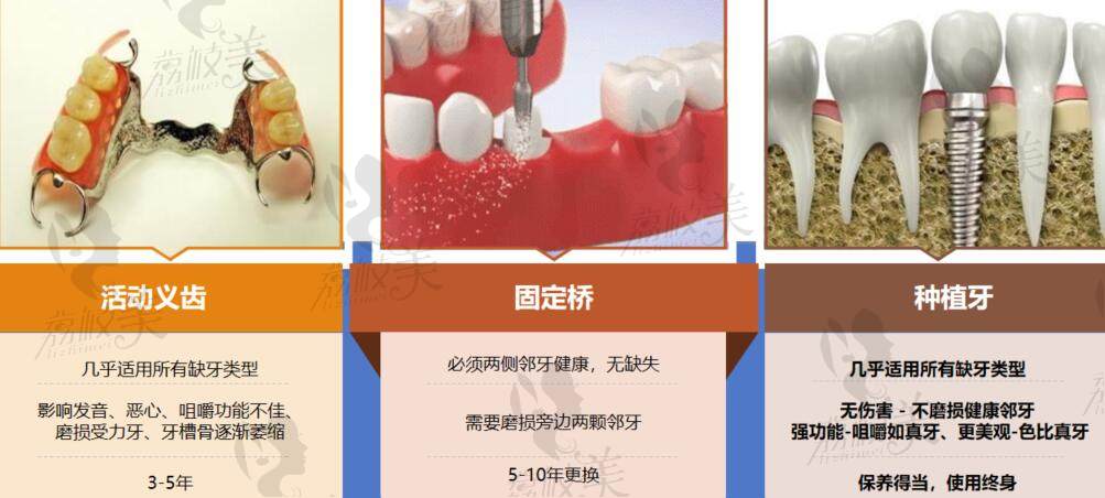 邹城玉红口腔种植牙怎么样