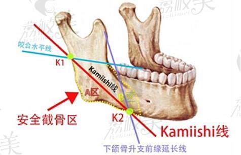 韓國顴骨內(nèi)推大師排名