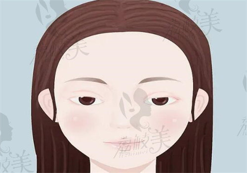 武汉吴茂源医生眼综合怎么样