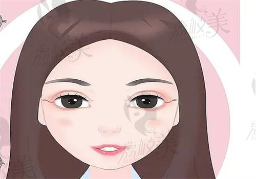 武汉吴茂源医生眼综合怎么样