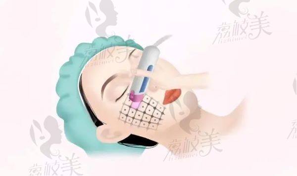 西双版纳华美之星美容医院评价