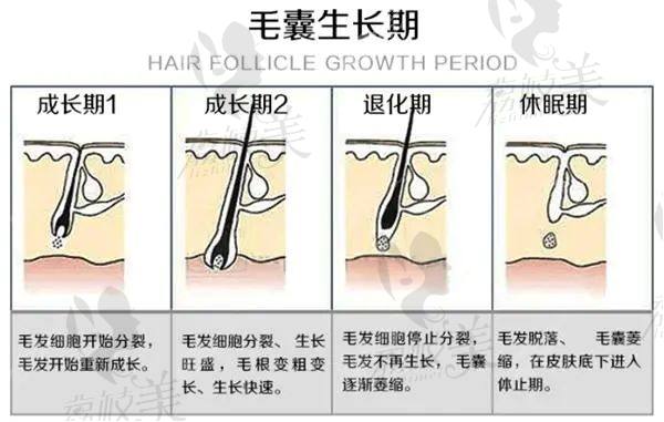 自然无痕植发的技术优势