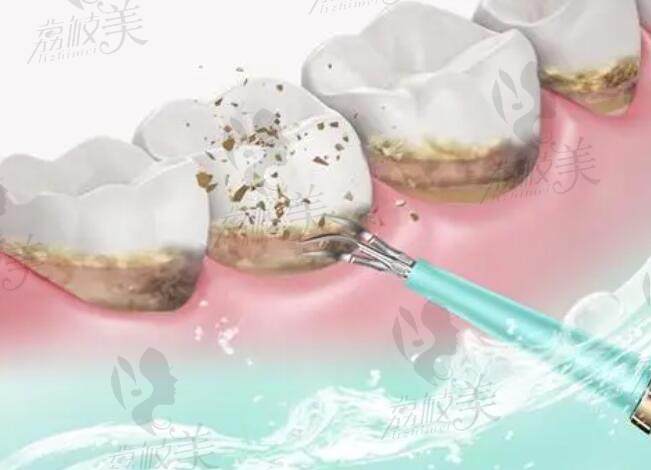 泉港优牙口腔医院怎么样
