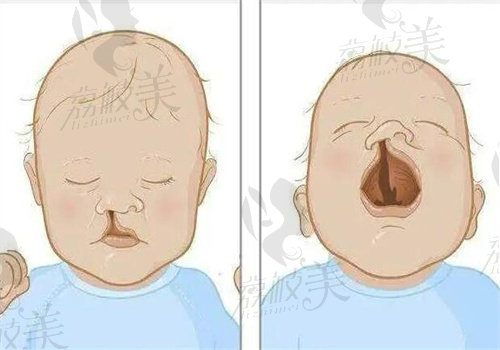 赵久丽博士实力