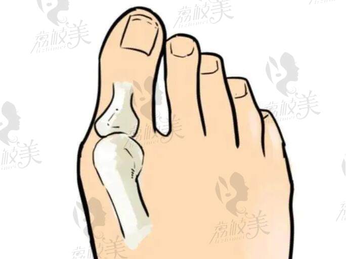 重慶騎士醫(yī)院在哪個(gè)位置