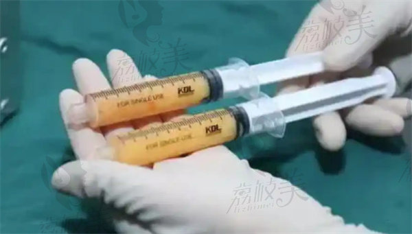 海南华美医学美容做吸脂塑形