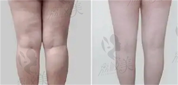 海南华美医学美容赵晓兰