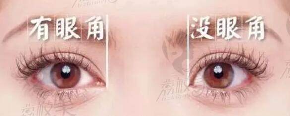 广州双眼皮修复哪个医生比较好