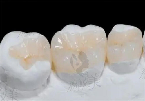 運(yùn)城運(yùn)中口腔李吉祥做成人補(bǔ)牙多少錢