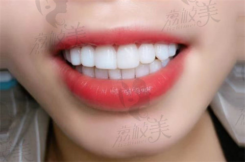 杭州西湖口腔醫(yī)院怎么樣