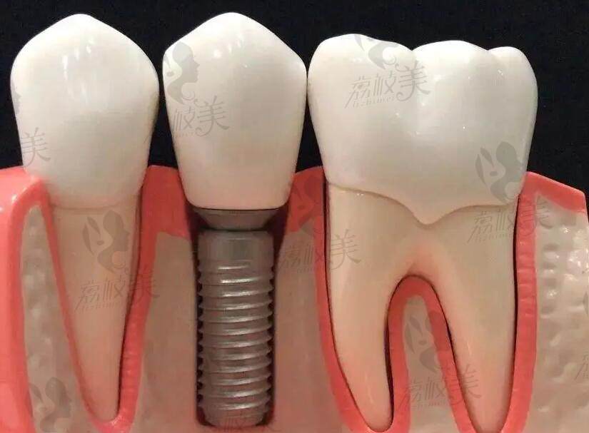 盐城牙益康口腔的正畸技术如何