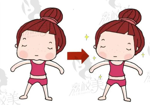 北京艺美王东做不带头套的面部吸脂单部位多少钱 北京艺美王东做不带头套的面部吸脂单部位多少钱