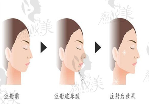 上海陈向东医生怎么预约挂号