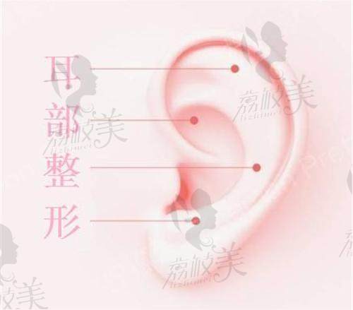 上海海華李營(yíng)醫(yī)生做耳再造手術(shù)多少錢(qián)