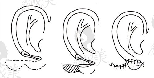 上海海華李營(yíng)醫(yī)生簡(jiǎn)介