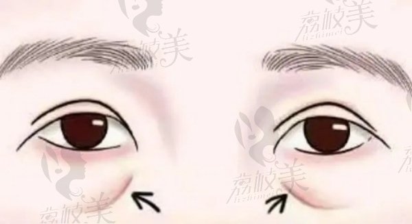 武汉陶娅医生注射技术怎么样
