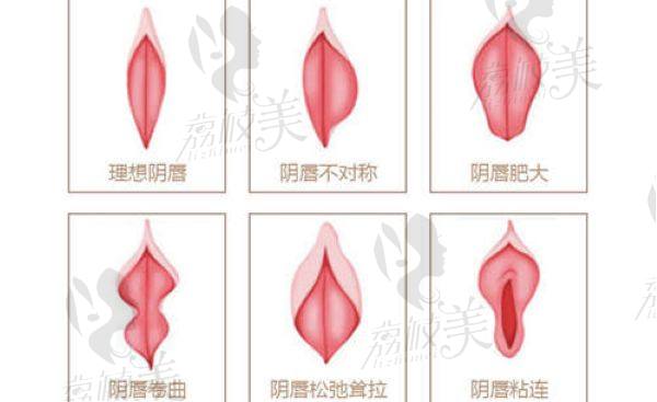 太原華晉醫(yī)院整形科做私密怎么樣