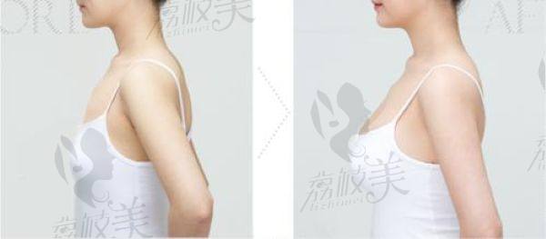 陽光醫(yī)院羅志敏看病特別貴嗎