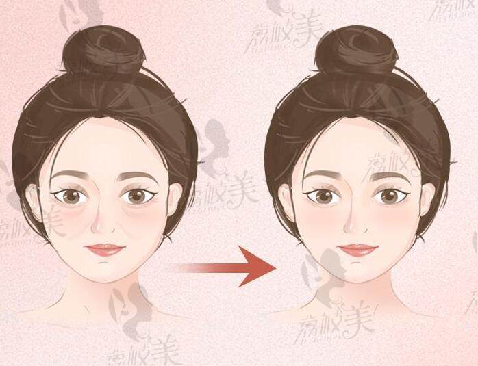 武汉整形医院哪家比较好