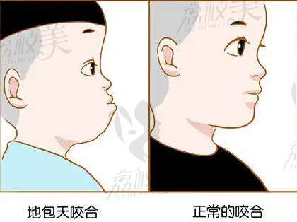 百适美隐形矫正中 心名声怎么样靠谱吗