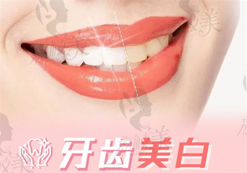 a5e567bbfddf1043c4c7e970e5b2655.jpg