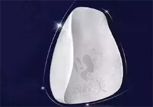 惠州致美口腔羅剛做樹脂貼面（6顆）技術(shù)特點