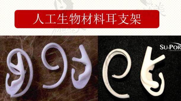 埋线精灵耳是怎么操作的