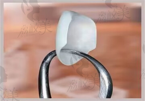 惠州致美口腔羅剛做樹脂貼面（6顆）相關(guān)優(yōu)勢