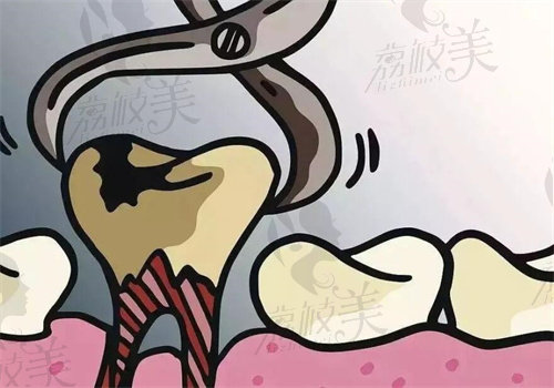 运城美瑞臣口腔樊跃旭做一次全口牙周治疗多少钱
