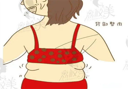 成都華生鉑悅王欣做吸脂馬甲線塑形技術(shù)特點(diǎn)