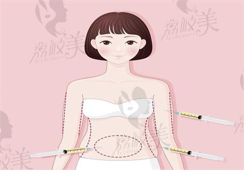 成都華生鉑悅王欣做吸脂馬甲線塑形口碑怎么樣