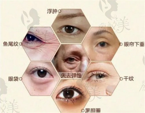 上海海華安洪賓做眼周年輕化