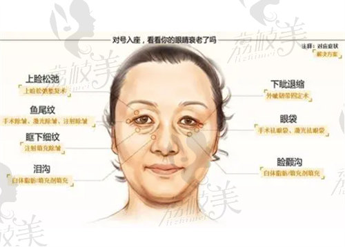 上海海華安洪賓做眼周年輕化