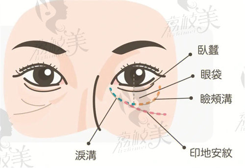 上海海華安洪賓做眼周年輕化