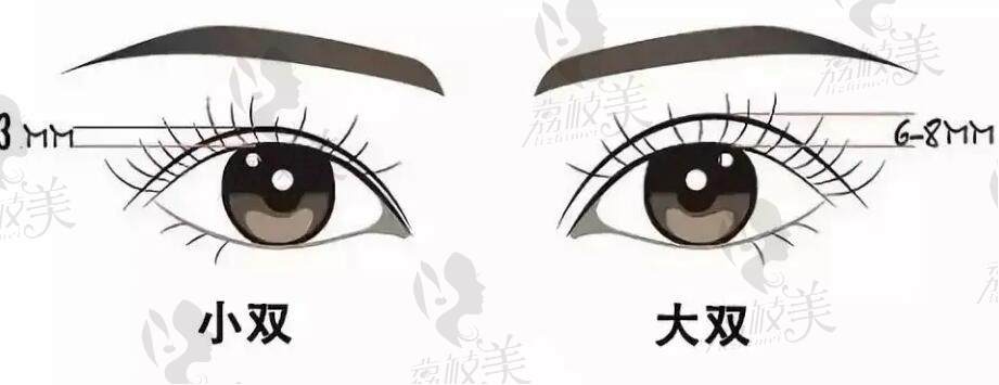 合肥雙眼皮修復(fù)醫(yī)生推薦榜單